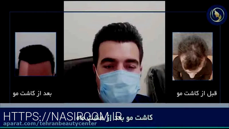 بهترین کلینیک پیوند و کاشت مو در ایران بهترین کلینیک کاشت مو در تهران کلینیک دکتر نیلفروش‌زاده